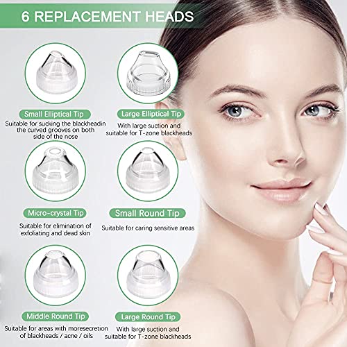 Blackhead Remover Pore Vacuum with 5MP Camera & 20X Magnification