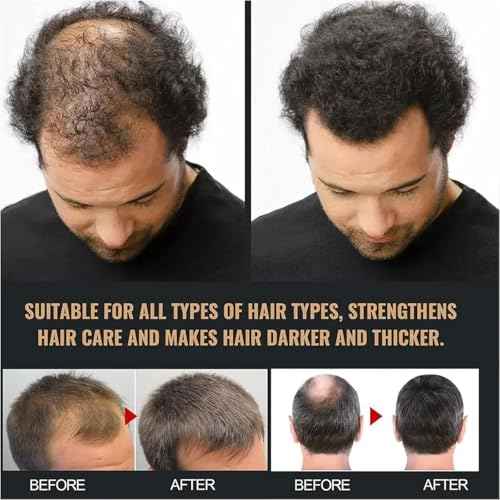 SPTAN Shampoo Root Activator Shampoo for Hair Growth & Thickness ? Anti Hair Loss Treatment | Reduces Shedding, Strengthens Follicles | Volumizing & Nourishing for Men & Women | Cruelty