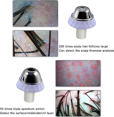 ZIJINGM Skin & Hair Scalp Analyzer 11-Inch HD LCD Microscope with 50X 200X Lenses