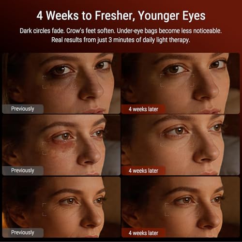 Red Light Therapy Eye Mask - 4 Wavelengths, 3-Minute Treatment