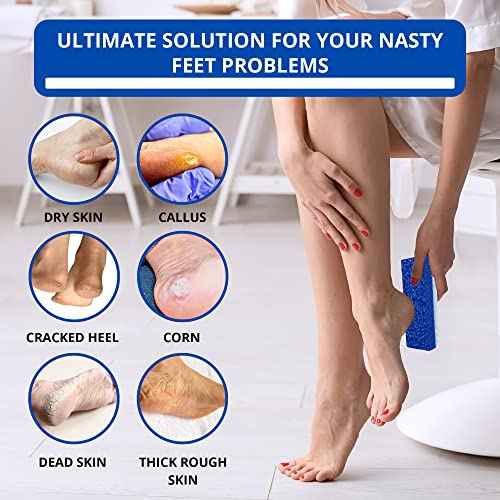 Love Natural Pumice Stone for Feet - Ultimate 2-in-1 Scrubber and Professional Exfoliating Rock for Feet Hands Body Care - Foot Stone for Dead Skin & Callus Removal (Blue)