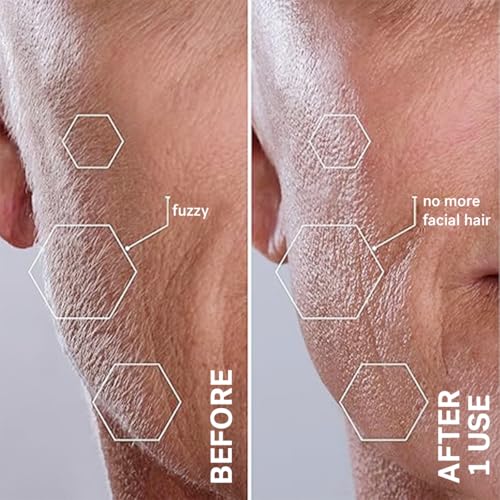Michael Todd Sonicsmooth Dermaplaning Tool | Sonic Facial Hair Remover