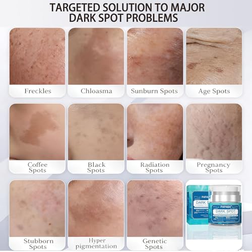 Tranexamic Acid Serum Dark Spot Corrector Cream for Face & Body Women Men - Niacinamide + Vitamin C - Brightening Treatment for Age Spots, Sun Spots Gentle for Sensitive Skin