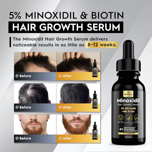Minoxidil Hair & Beard Growth Serum 5% - Supports Thicker Hair & Beard, 3 Pack