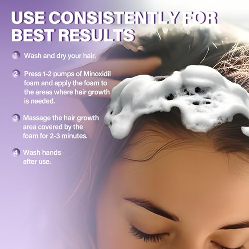 5% Minoxidil Foam for Women - Hair Growth Treatment for Thinning Hair