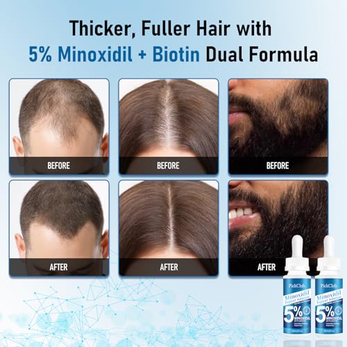 5% Minoxidil + Biotin Hair Regrowth Serum for Men & Women, 2-Pack