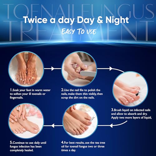 OSIMOON Extra Strength Toenail Fungus Treatment - 10% Undecylenic Acid (30ml)