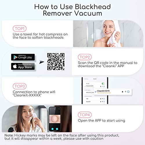 HD Camera Blackhead Remover Vacuum with LED Lighting - 3 Modes, 6 Suction Heads, Smartphone App