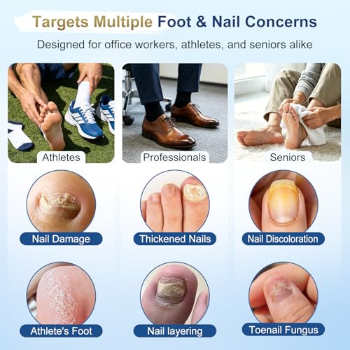 Toenail Fungus Treatment Pen Kit with Sanitizer - 25% Undecylenic Acid