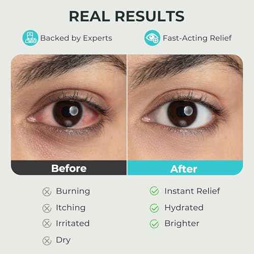 Steam Eye Masks for Dry Eyes: Self Heating Moist Warm Compress for Digital Eye Strain Stye - 10 Packs Spa Relaxation Essentials for Fast Sleep | Airplane Travel | Office Nap | Meditation, Unscented