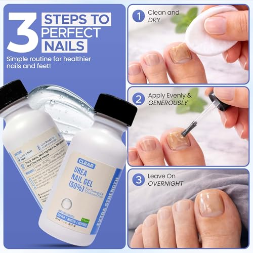 Blue Urea 50% Nail Gel for Cracked Heels & Thick Toenails - Soften & Restore