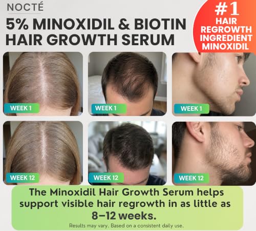 Nocte 5% Minoxidil Hair Regrowth Spray for Men & Women
