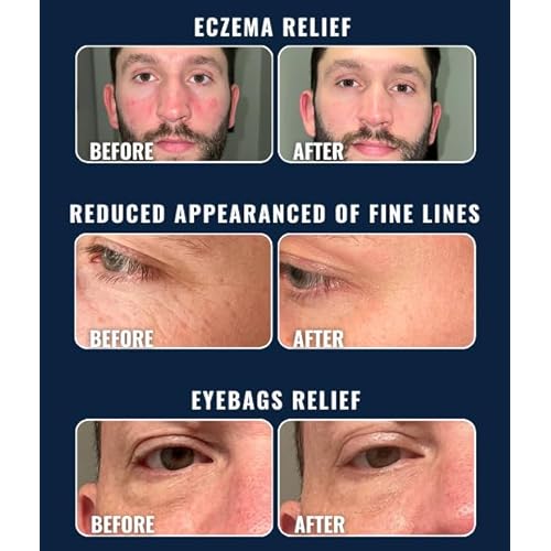 Prettyboy Face Revival Gel Moisturizer For Men - Hydrating Cream That Refreshes Dry Skin, Irritation, & Redness - Supports Anti Aging & Anti Wrinkle - Fragrance Free - 1 Count