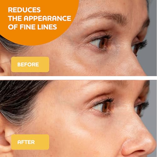 Vitamin C Serum with Hyaluronic Acid, Niacinamide & Natural Extracts ? Hydrating & Brightening Face Serum ? Helps reduce the Look of Dark Spots, Dullness & Pores ? For All Skin Types