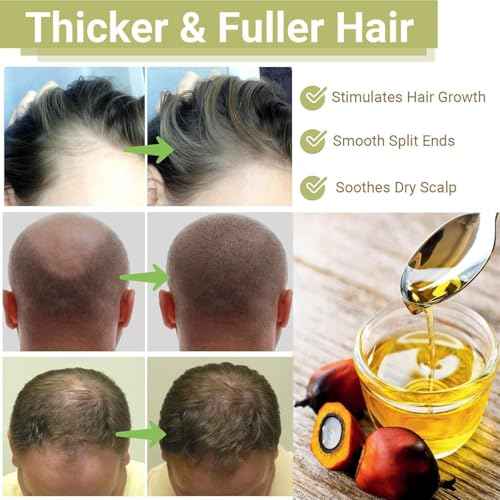 Minnah Beauty¢â Hair Growth Oil, Crack Hair Growth 4-in-1 Liquid Batana Oil with Rosemary, Pumpkin Seed, Castor