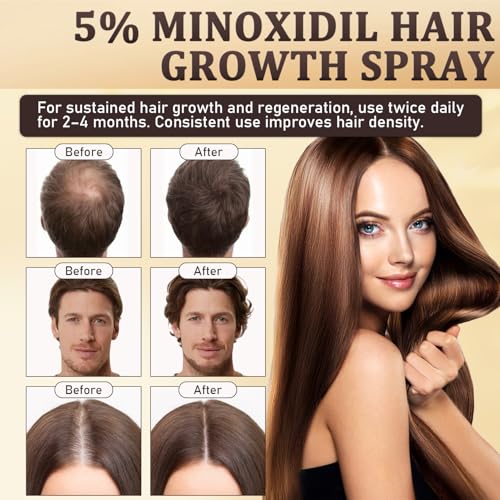 5% Minoxidil Hair & Beard Growth Spray - Extra Strength 3.38oz