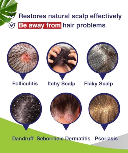 Anti-Fungal Medicated Shampoo for Seborrheic Dermatitis & Folliculitis