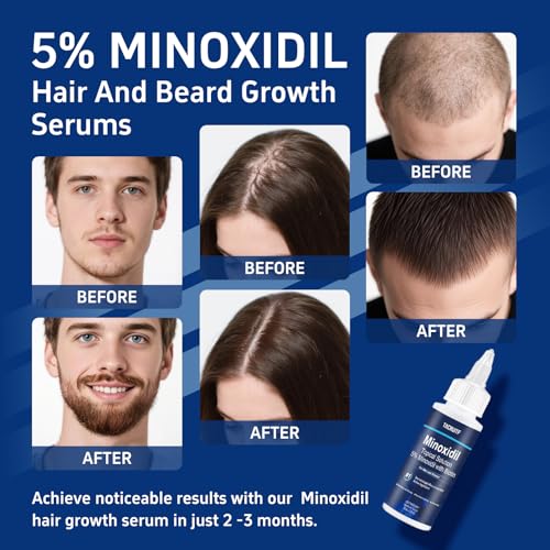 5% Minoxidil Hair Growth Serum for Men & Women, 4 Pack