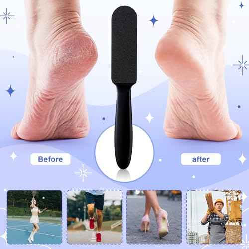 Mudder 2 Pieces Stainless Steel Pedicure Foot File Callus Remover Foot Scrubber Rasp with 20 Replaceable Coarse/Fine Double Side Reusable Pads for Care Cracked Skin Callus Remover Tool(Black)