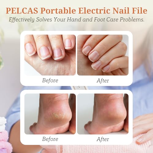 Pelcas Electric Toenail Grinder for Thick Nails - 5 Speeds & LED Light