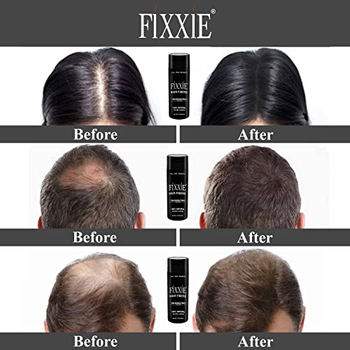 FIXXIE Black Hair Fibers for Thinning Hair 27.5g Bottle - Natural Keratin Hair Concealer for Men & Women