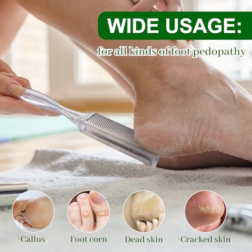 MR.A Epsom Salt Foot Soak with Tea Tree & Lavender Oils - Spa Pedicure for Calluses & Odor