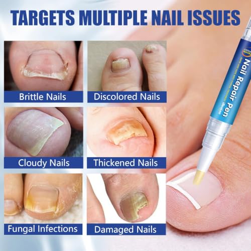 Extra Strength Toenail Fungus Treatment Pen with Tea Tree Oil