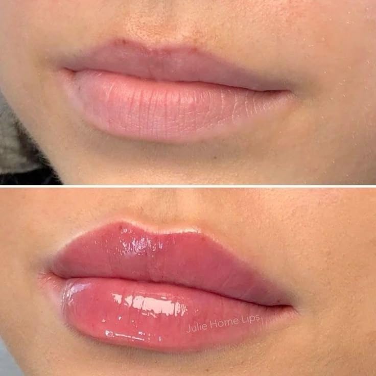 Top Bella Electric Lip Plumper with Vibration Massage