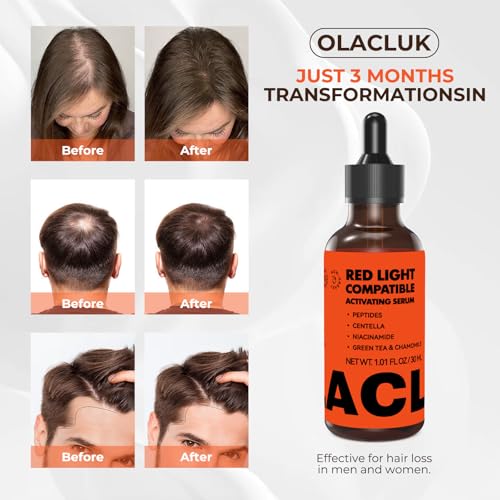 Copper Peptide Hair Growth Serum for Red Light Therapy
