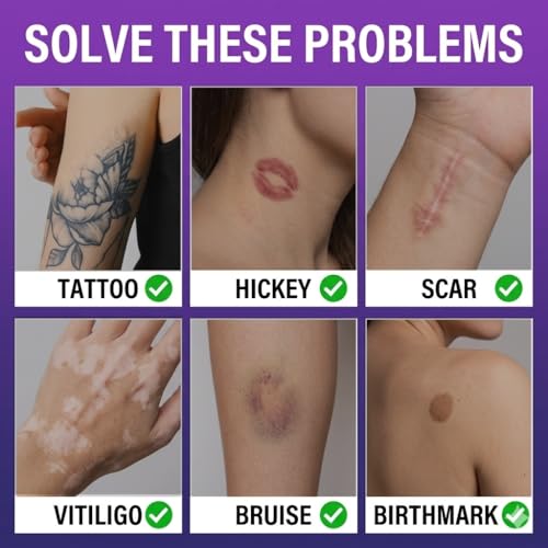 Tattoo Cover Up Makeup Kit - Waterproof Skin Concealer for Scars & Blemishes