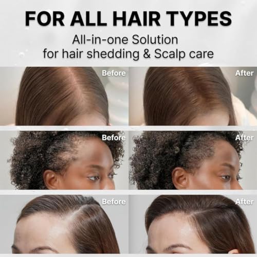 Hair Growth Serum with Scalp Brush | Volume & Thickening