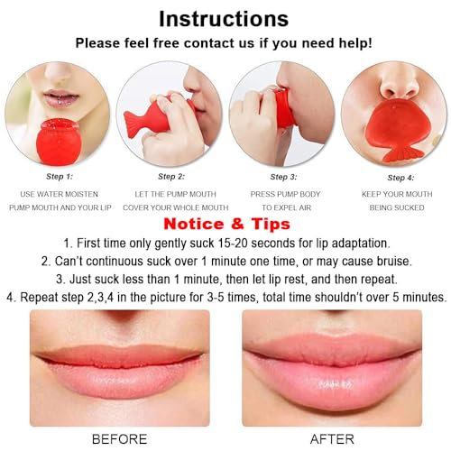 Lip Plumper Device - Silicone Suction Tool for Fuller Lips