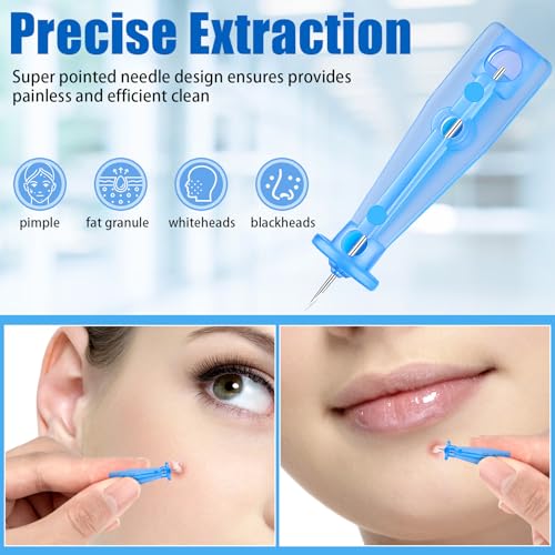Sterile Lancets for Blackhead Removal, 100 Pack Pimple Needles