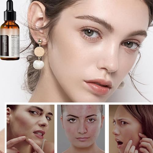 Vitamin C Serum For Face, Anti Aging Face Serum with Vitamin C, Hyaluronic Acid, Vitamin E ? Brightening Formula ? Improve Appearance of Dark Spots, Tone, Fine Lines & Wrinkles (2Pcs)