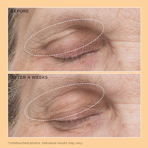 Perricone MD Neuropeptide Eyelid Lift Serum 0.5fl oz