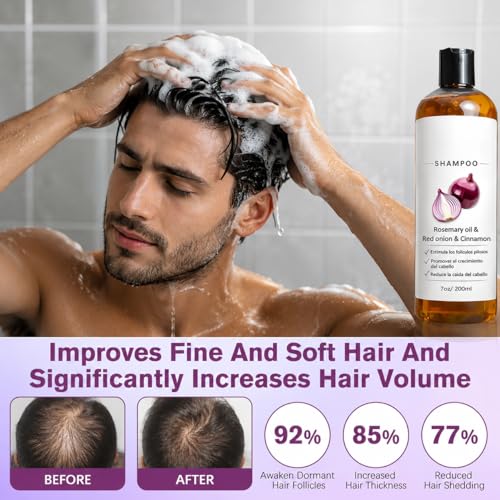 Onion Shampoo for Hair Loss & Growth - 200ml