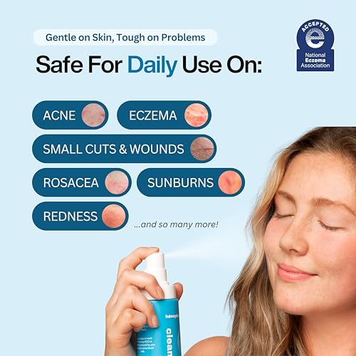 Honeydew Labs Hypochlorous Acid Spray ? HOCl Face & Skin Mist for Acne, Eczema & Irritation ? Multi-Purpose Skin Repair ? Eyelid Cleanser, Post-Workout, Post-Procedure, Scalp & Sensitive Skin ? 6.8 oz