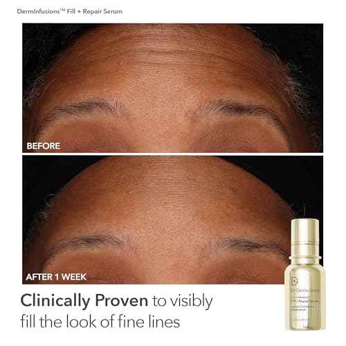 Dr. Dennis Gross Fill, Plump & Firm Kit ? DermInfusions¢â Hyaluronic Acid Serum, Eye Cream & Lip Treatment | Boost Hydration, Smooth Fine Lines & Enhance Volume | $125 Value Limited Edition Gift Set