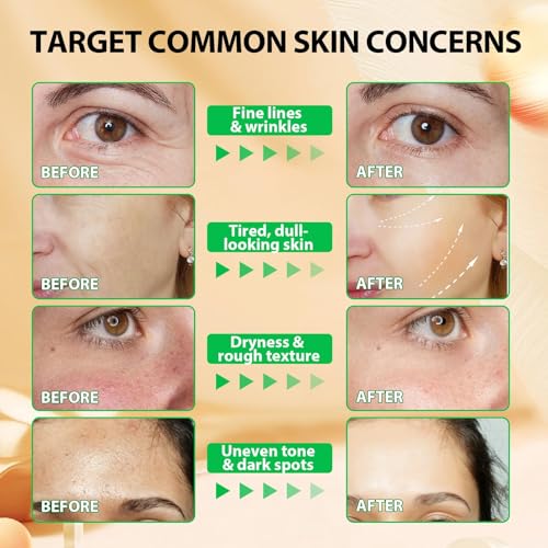 Vitamin E Oil for Skin,75,000 IU Pure Vitamin E Oil for Face, Hair,Nail & Body Tightening Plump Skin,Reduce Fine Lines & Scars,Non-GMO