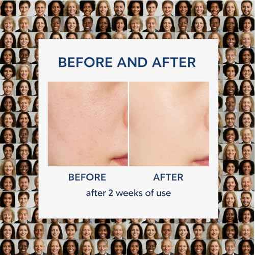 Dr Alpha Skin Barrier Cream 80ml, Moisturizing for Dry, Sensitive Skin, Face Care Lotion, Rejuvenating Face, Body, Legs