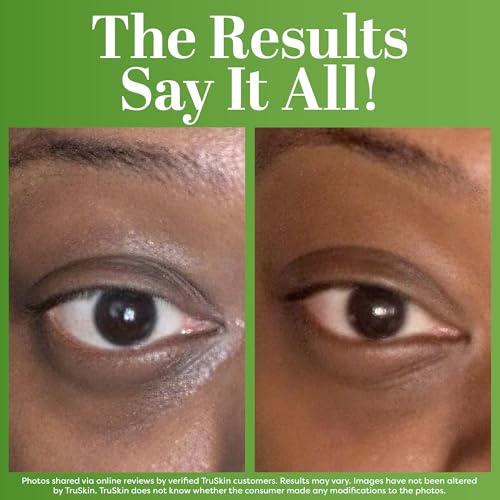TruSkin Peptide Eye Cream Gel | Dark Circles & Fine Lines, 0.5oz