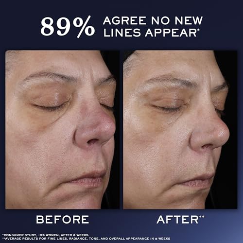 Lancôme Génifique Hydrating Anti-Aging Serum - Refillable with Hyaluronic Acid