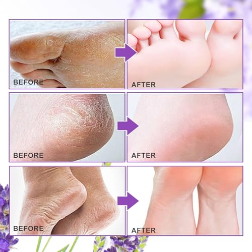 ALIVER Foot Peel Mask 3 Pack - Exfoliating Callus Remover for Soft Feet