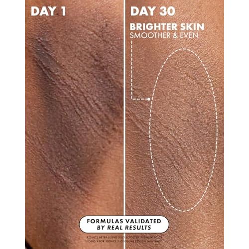 Truly Beauty Jelly Booster Pigment Body Potion, Lightweight, Fast Absorbing Acne Scar Treatment for Face And Body, Scar Removal Ointment/Serum for Everyday Use, 3.1 Fl.Oz
