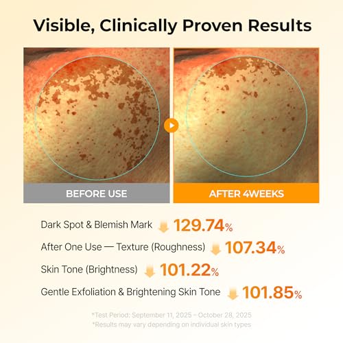 Korean Kojic Acid Turmeric Brightening Toner Pads for Dark Spots - 70 Sheets