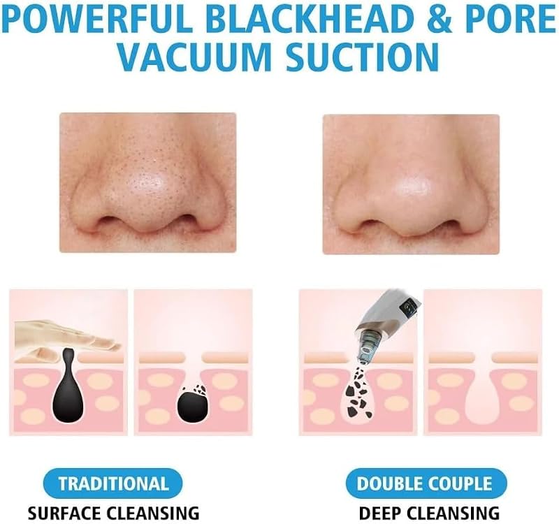 Professional Blackhead Remover Vacuum with 3 Suction Levels