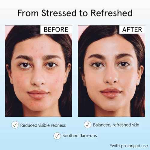 grace & stella Hypochlorous Acid Spray for Face - Acne Spray - Gentle Face Mist to Calm Redness, Flare-Ups, Breakouts, Body Acne, Bacne - Soothing Facial Mist for Sensitive Skin (120ml/4 fl oz)