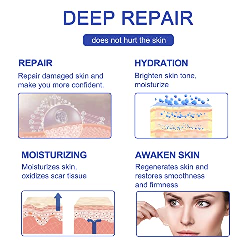 New Transparent Silicone Scar Sheets(1.6¡± x 120¡±Inch - 3M),Away Scar Tape,Scar Strips, Reusable, Professional Scar Removal Sheets for C-Section, Surgery, Burn, Keloid, Acne et, Scar Patch.