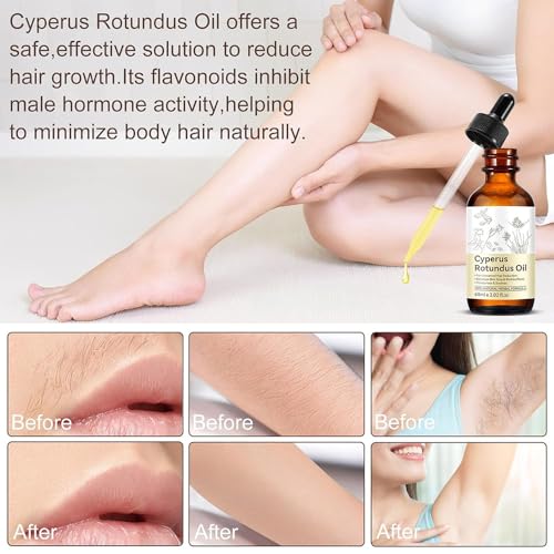 Cypress Rotundus Oil for Hair Removal - Reduces Hair Growth & Soothes Skin