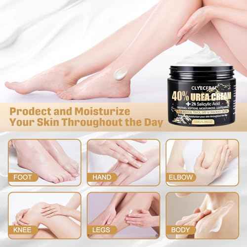 40% Urea Cream with 2% Salicylic Acid, Urea Cream 40 Percent for Feet & Hands- Maximum Strength Moisturizer for Rough, Dry, Thick & Cracked Skin, Callus Remover, Deep Hydration, 150g